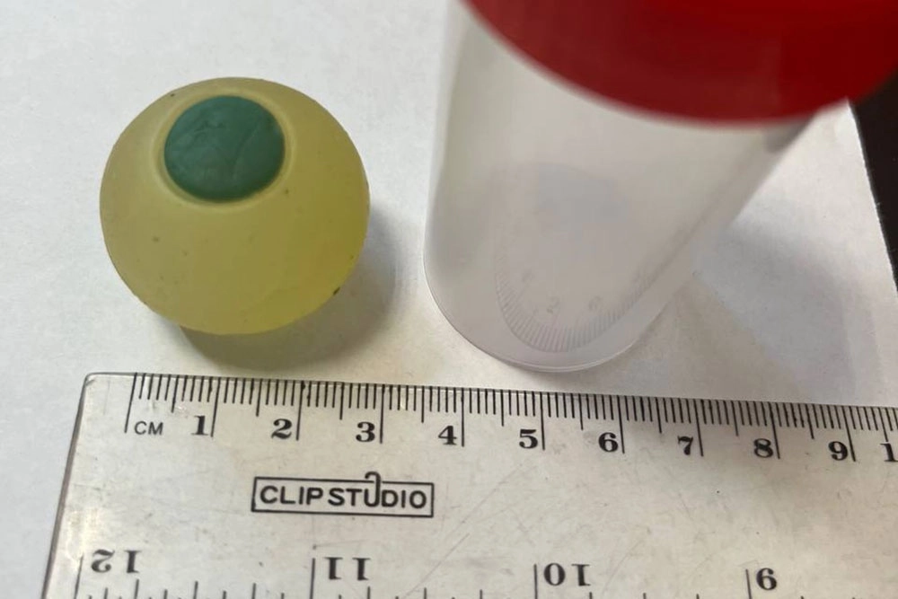 В Челябинске врачи извлекли из кишечника ребёнка силиконовый глаз